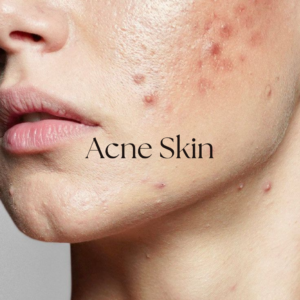Natural skin solutions with herbal ingredients for healthy, glowing, and nourished skin care.
