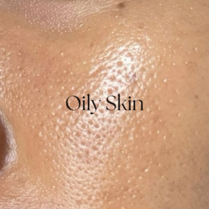 Natural skin solutions with herbal ingredients for healthy, glowing, and nourished skin care.