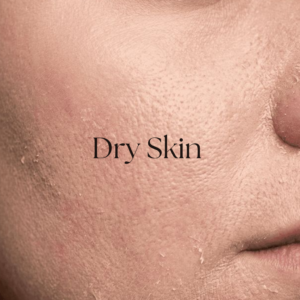 Natural skin solutions with herbal ingredients for healthy, glowing, and nourished skin care.