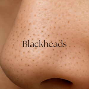 Natural skin solutions with herbal ingredients for healthy, glowing, and nourished skin care.