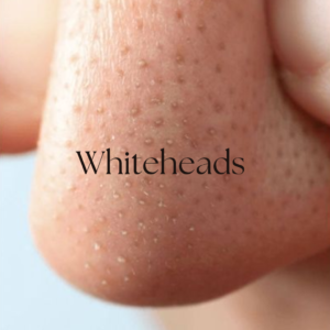 Natural skin solutions with herbal ingredients for healthy, glowing, and nourished skin care.